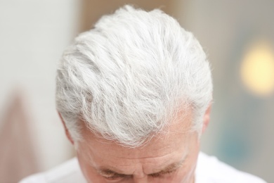 Senior man with hair loss problem indoors, closeup