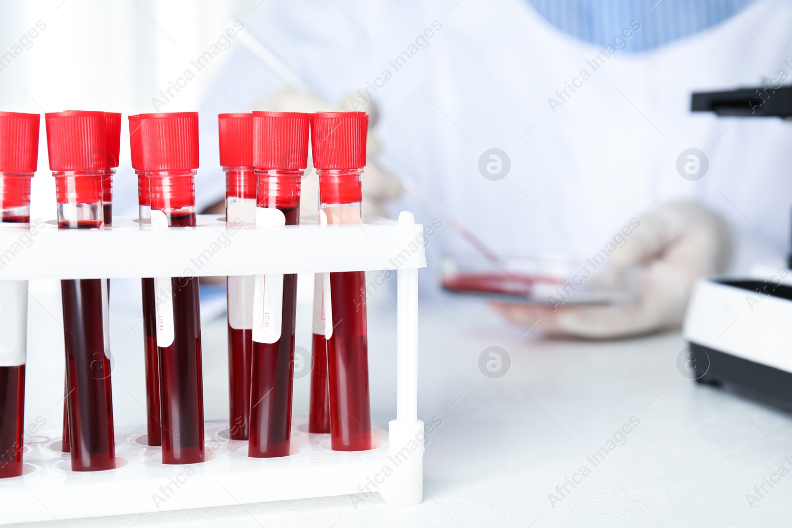 Photo of Test tubes with blood samples on table in laboratory. Virus research