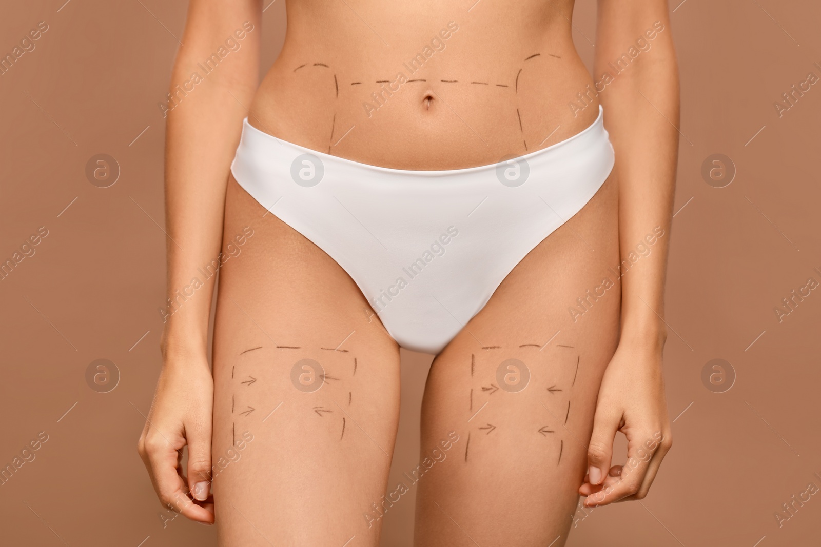 Photo of Slim woman with markings on body before cosmetic surgery operation on light brown background, closeup