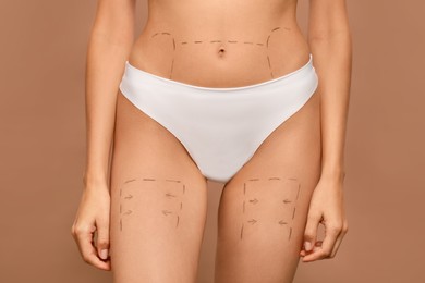 Slim woman with markings on body before cosmetic surgery operation on light brown background, closeup