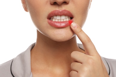 Image of Woman with herpes touching lip on white background, closeup