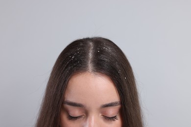 Photo of Woman with dandruff problem on grey background, closeup