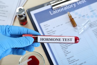 Photo of Hormones test. Scientist holding sample tube with blood at table, closeup
