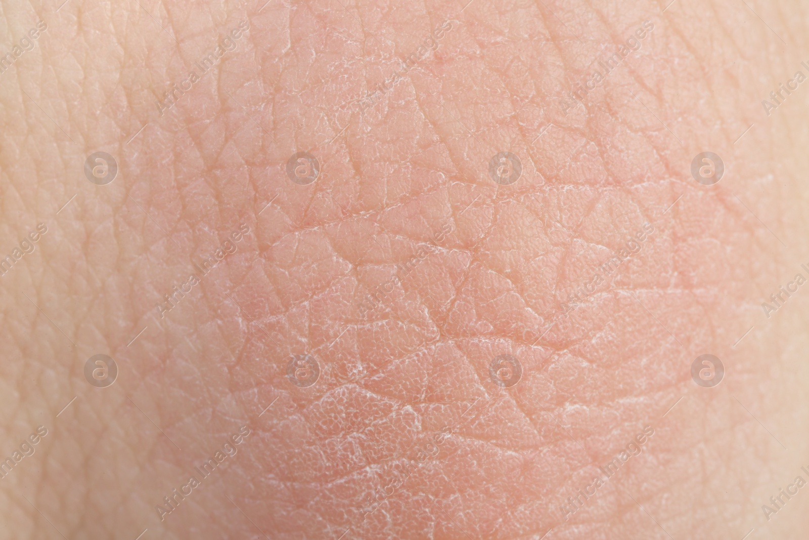 Photo of Texture of healthy skin as background, macro view