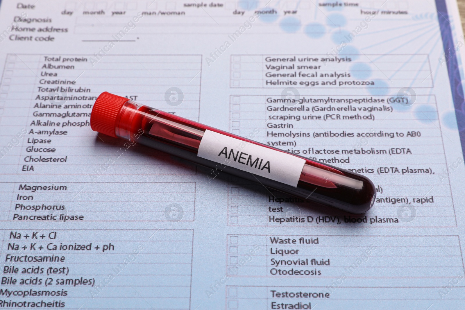 Photo of Test tube with blood sample and label Anemia on medical form