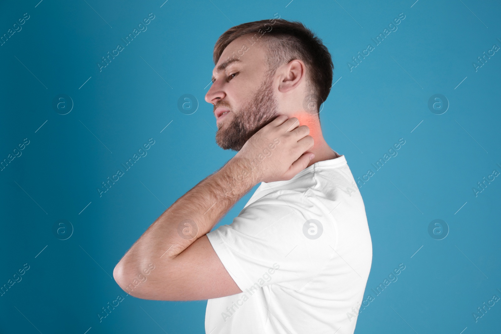 Photo of Man scratching neck on color background. Allergy symptoms