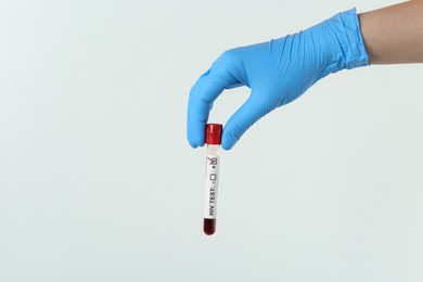 Scientist holding tube with blood sample and label HIV Test on light background, closeup