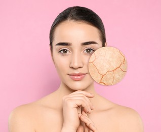Image of Young woman with facial dry skin problem on pink background