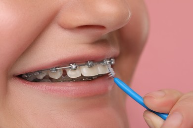 Woman with dental braces cleaning teeth using interdental brush on pink background, closeup