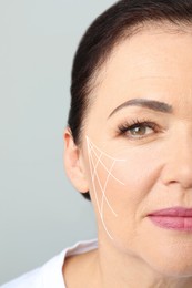 Image of Beautiful mature woman after facelift cosmetic surgery procedure on grey background, closeup