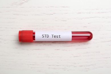 Photo of Tube with blood sample and label STD Test on white wooden table, top view