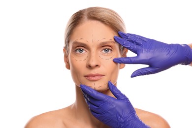 Doctor checking patient's face before cosmetic surgery operation on white background