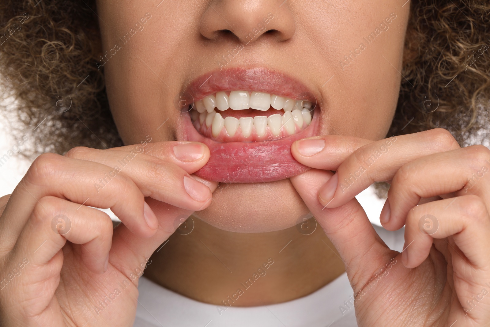 Photo of Woman showing her clean teeth, closeup view