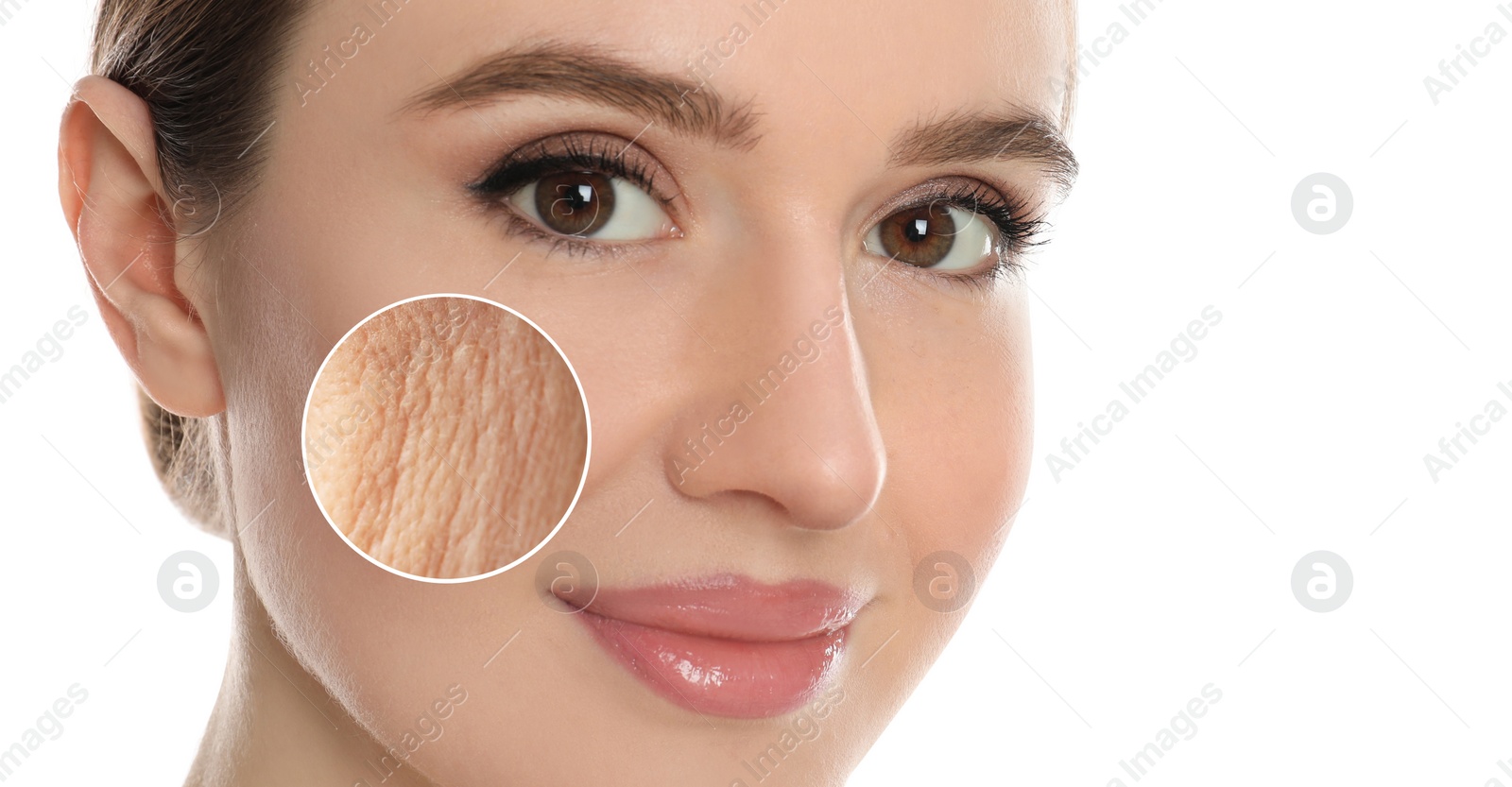 Image of Young woman with skin problem on white background, closeup. Banner design