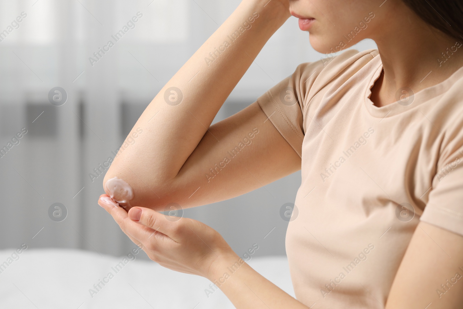 Photo of Young woman with dry skin applying cream onto her elbow indoors, closeup