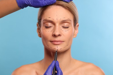 Photo of Doctor with marker preparing patient for cosmetic surgery operation on light blue background, closeup