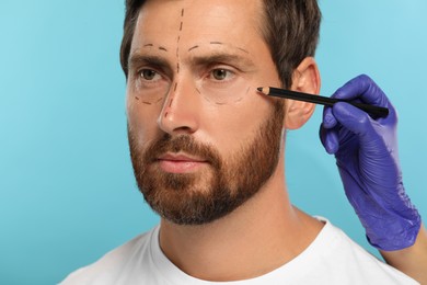 Doctor with pencil preparing patient for cosmetic surgery operation on light blue background, closeup