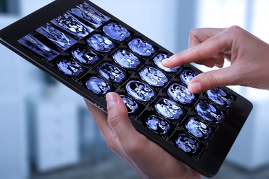 Image of Doctor examining x-ray images on tablet indoors, closeup