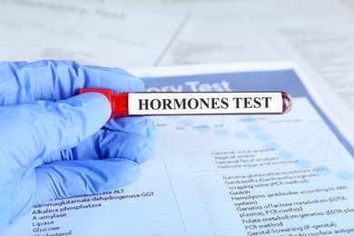 Photo of Hormones test. Scientist holding sample tube with blood against laboratory form, closeup