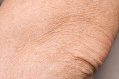 Photo of Closeup view of mature person with clean skin on elbow