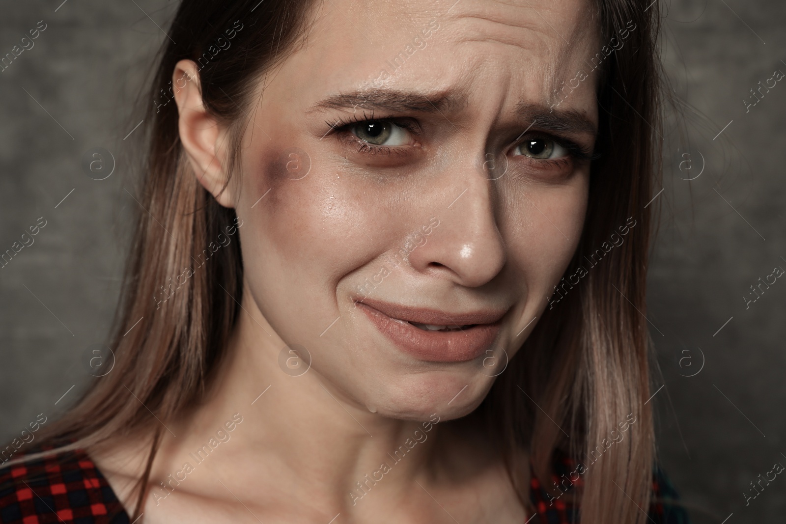 Photo of Abused young woman on grey background. Stop violence