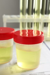 Photo of Containers with urine sample for analysis on test form in laboratory