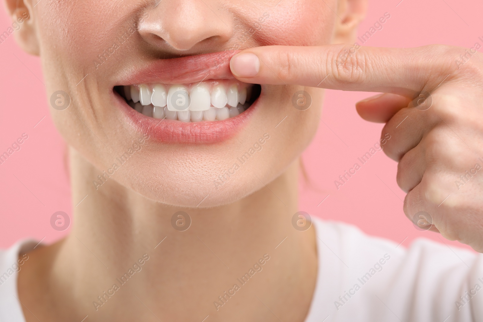 Photo of Woman showing her clean teeth on pink background, closeup