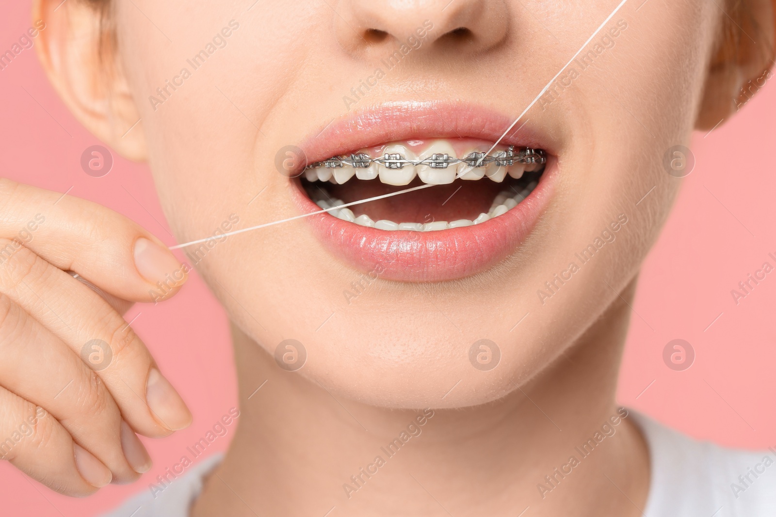 Photo of Woman with braces cleaning teeth using dental floss on pink background, closeup