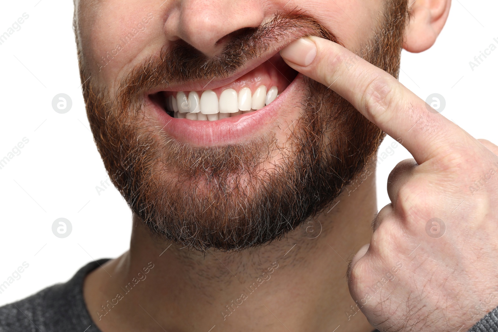 Photo of Man showing his healthy teeth and gums on white background, closeup