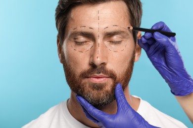 Doctor with pencil preparing patient for cosmetic surgery operation on light blue background, closeup