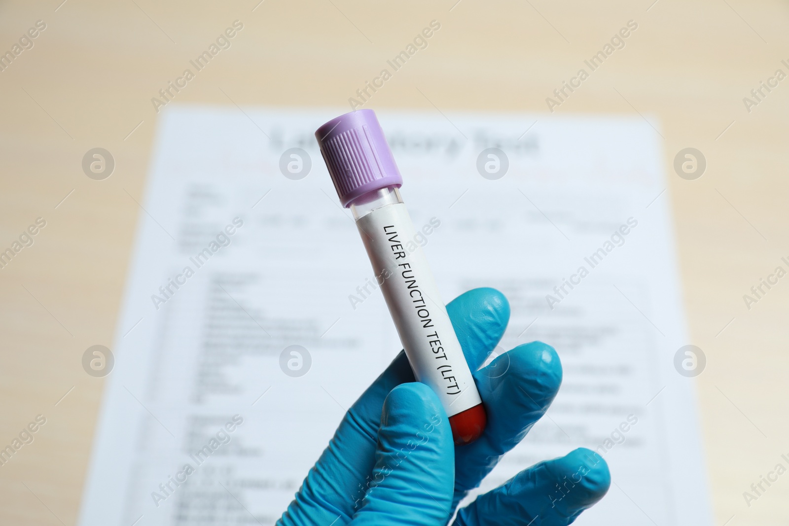 Photo of Laboratory worker holding tube with blood sample and label Liver Function Test over table, closeup