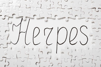 Photo of Puzzle pieces and word Herpes written on white background, flat lay