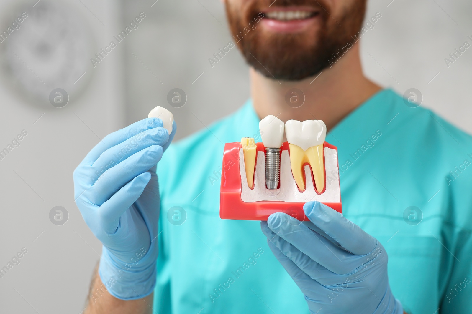 Photo of Dentist holding educational model of dental implant on blurred background, closeup