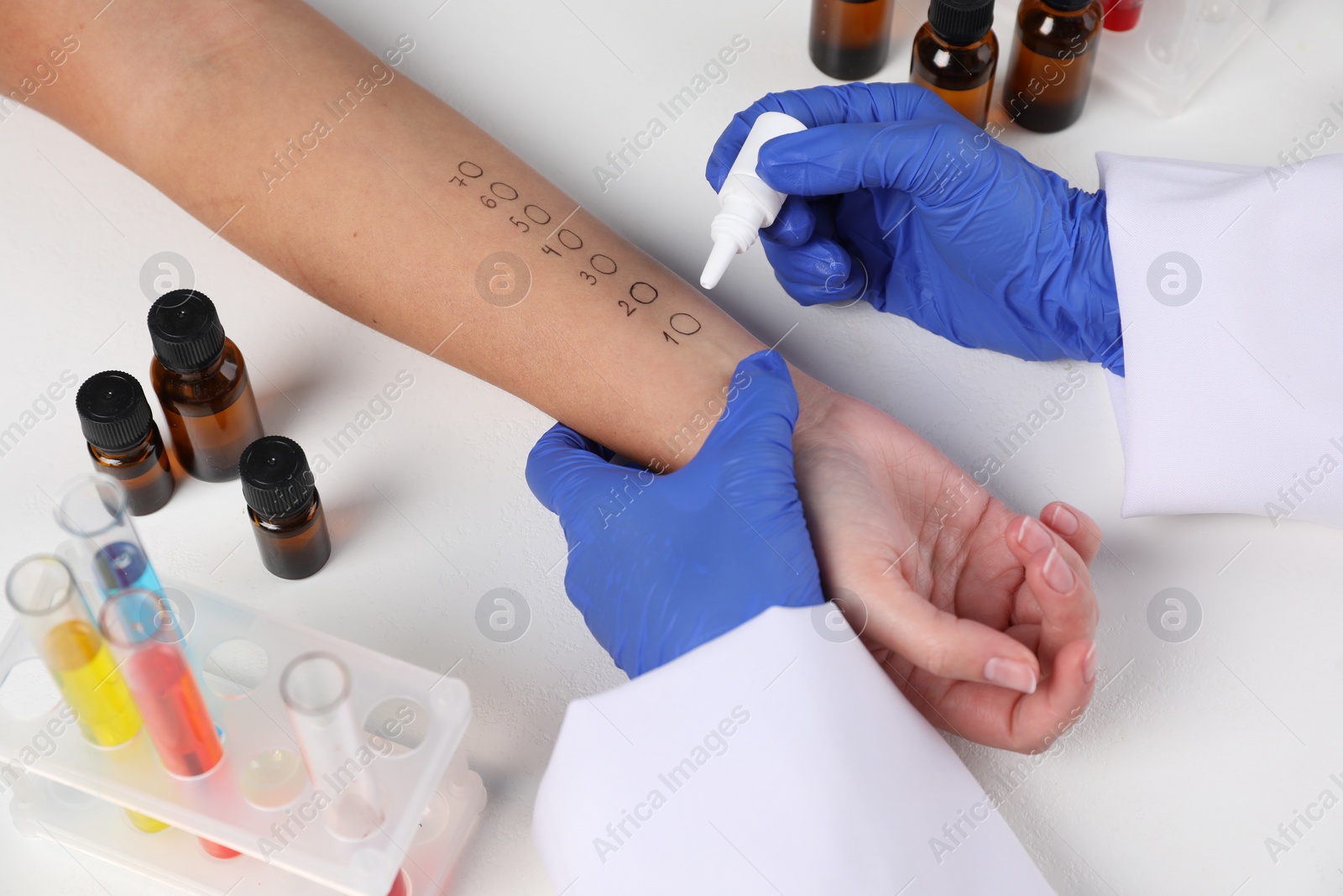 Photo of Doctor doing skin allergy test at light table, closeup