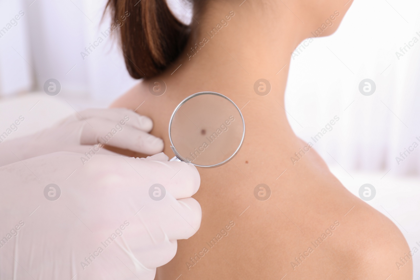 Photo of Dermatologist examining patient with magnifying glass in clinic, closeup view