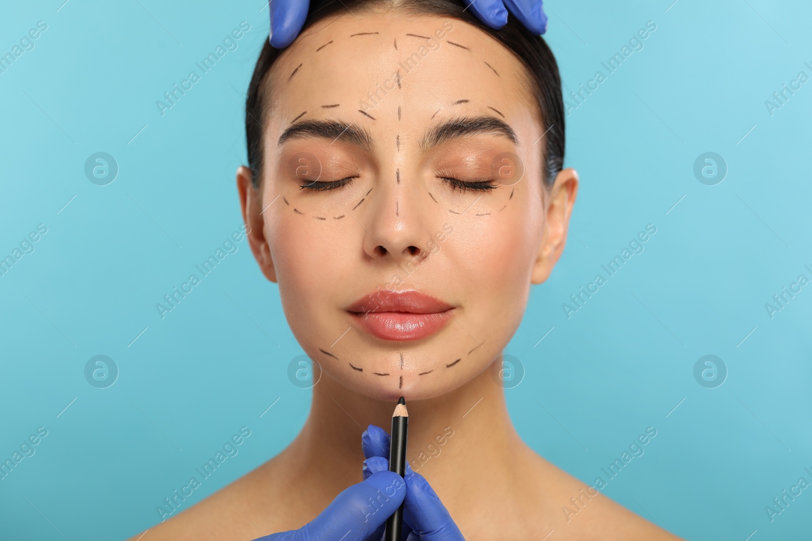 Photo of Doctor with pencil preparing patient for cosmetic surgery operation on light blue background, closeup