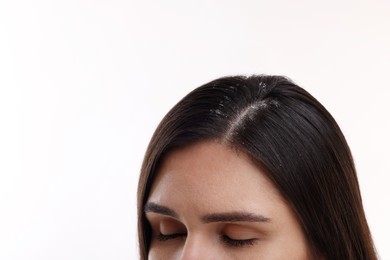 Photo of Woman with dandruff in her dark hair on white background, closeup. Space for text