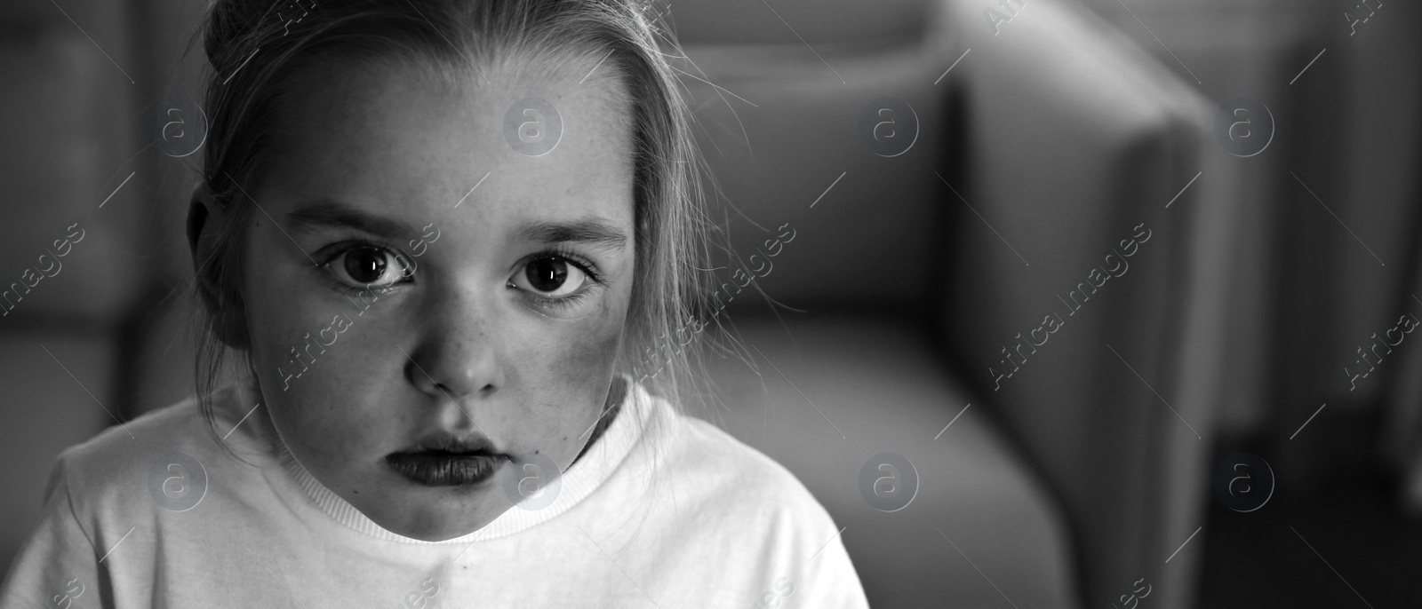 Image of Little girl with bruises on face at home, space for text. Domestic violence victim. Banner design