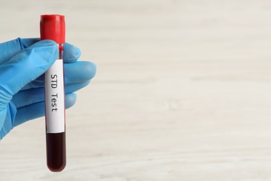 Scientist holding tube with blood sample and label STD Test on white background, closeup. Space for text