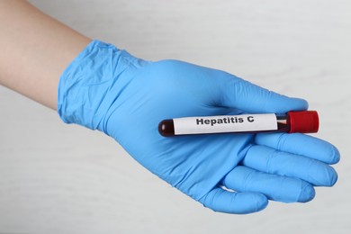 Photo of Scientist holding tube with blood sample and label Hepatitis C on light background, closeup