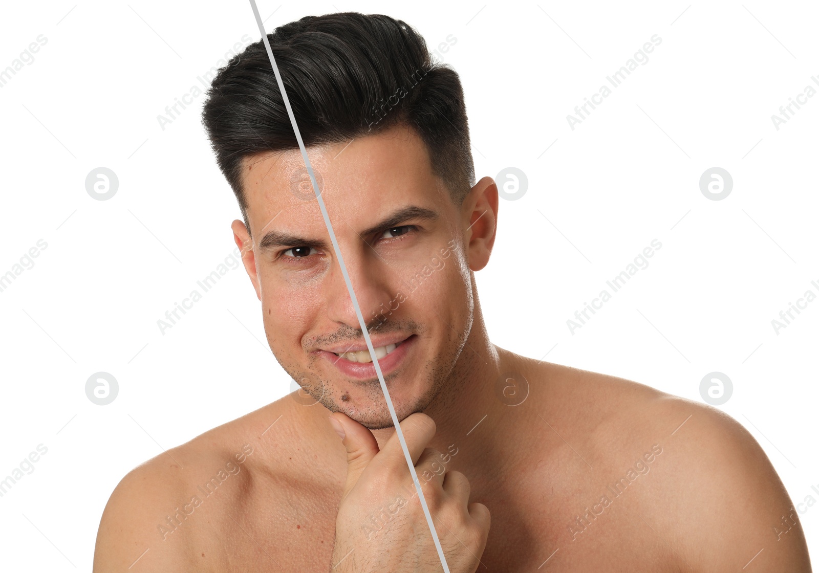 Image of Photo before and after retouch, collage. Handsome man on white background