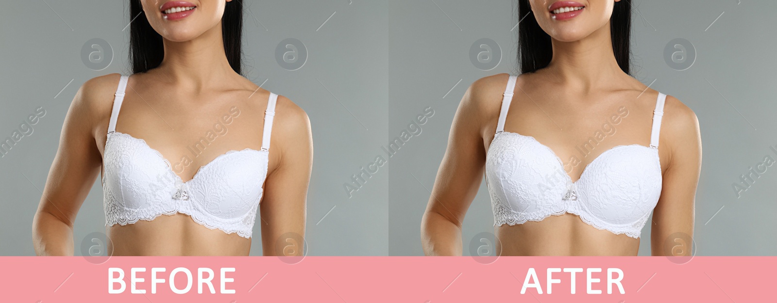 Image of Woman before and after breast augmentation on light grey background, closeup. Banner design