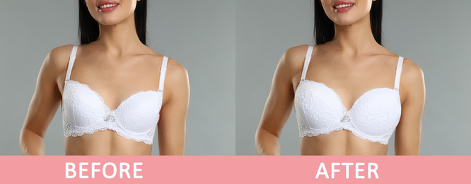 Woman before and after breast augmentation on light grey background, closeup. Banner design