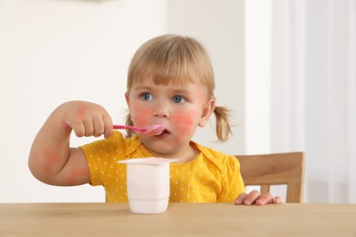 Image of Cute little child with allergic redness eating tasty yogurt at wooden table indoors