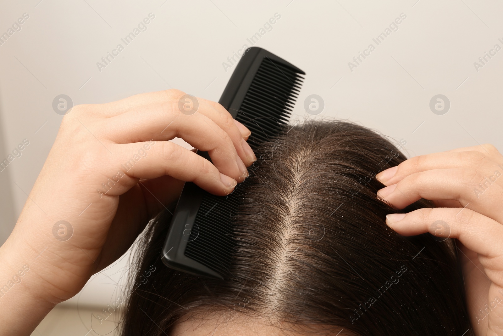 Photo of Woman with comb and dandruff in her dark hair on light background, closeup