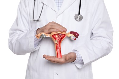 Photo of Doctor demonstrating model of female reproductive system on white background, closeup. Gynecological care