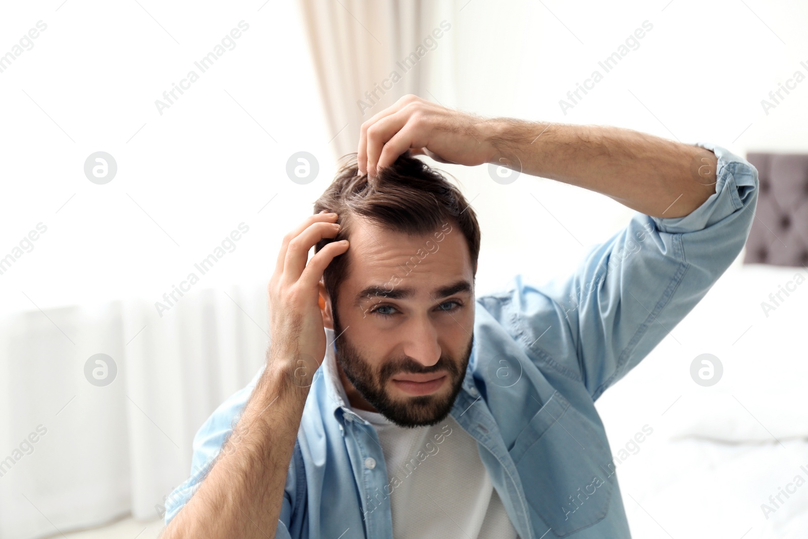 Photo of Young man with hair loss problem indoors