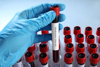 Photo of Monkeypox virus test. Laboratory worker putting sample tube with blood into rack, closeup