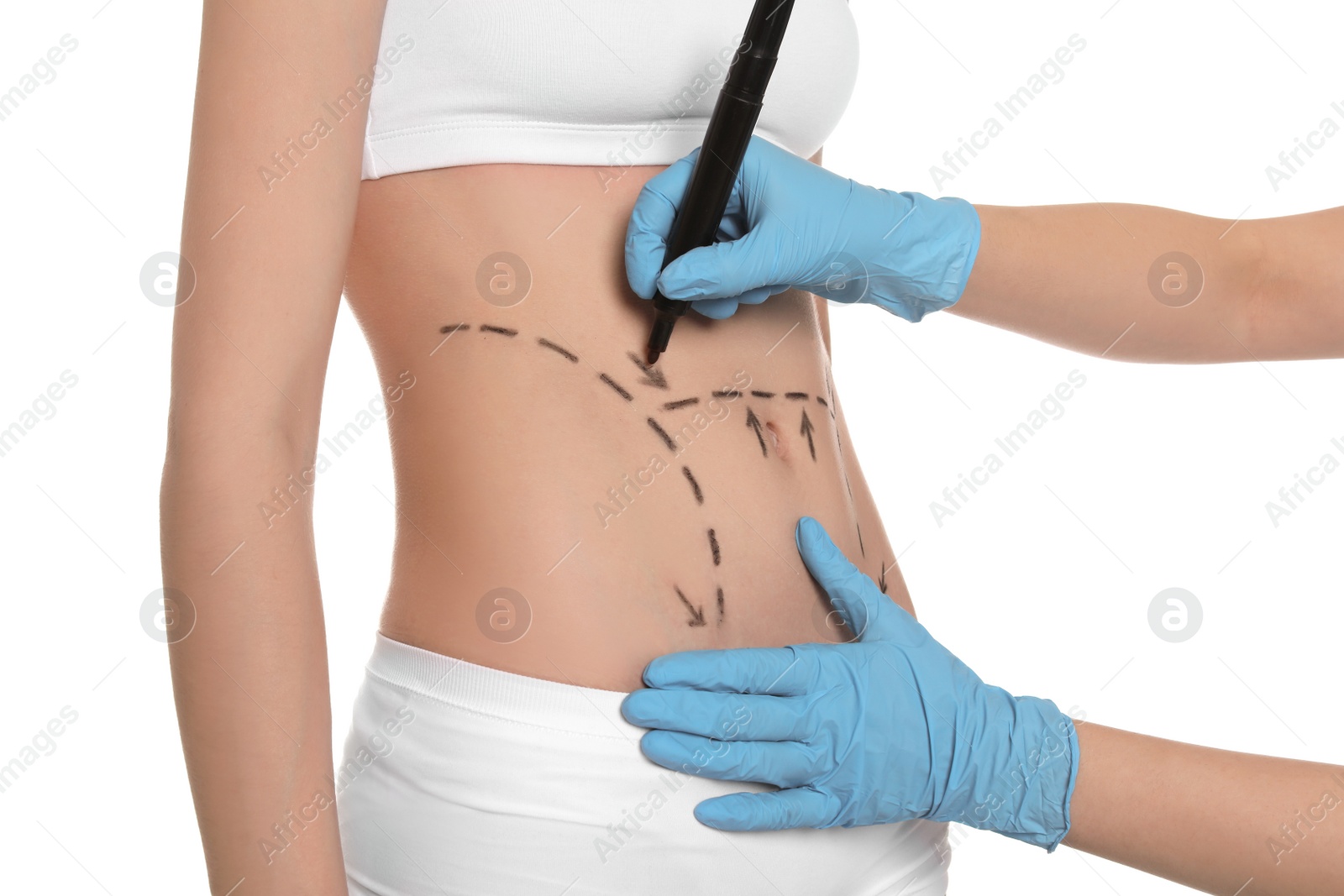 Photo of Doctor drawing marks on female belly for cosmetic surgery operation against white background