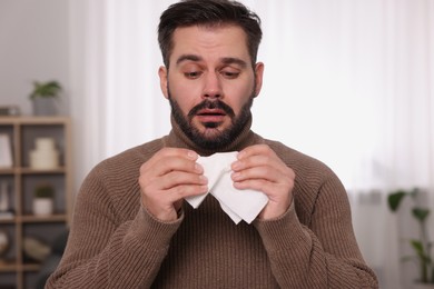 Photo of Sick man with tissue at home. Cold symptoms